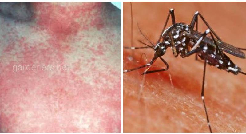 Лихорадка Денге - смертельно опасное вирусное заболевание, которое переносят комары 