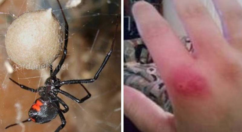 Чи небезпечна отрута павука-каракурта? Симптоми дії отрути та що робити, якщо вкусив?