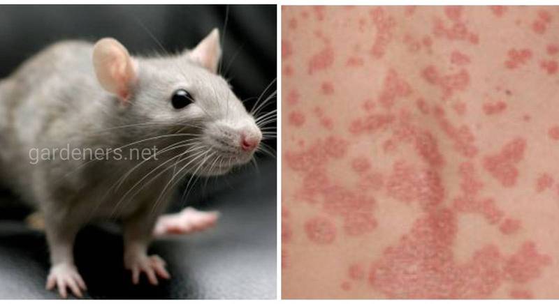 Крысиный сыпной тиф - острое инфекционное заболевание, передающееся от крыс и мышей