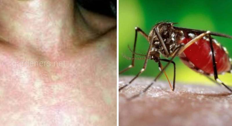 Лихоманка Денге - смертельно небезпечне вірусне захворювання, яке переносять комарі Aedes