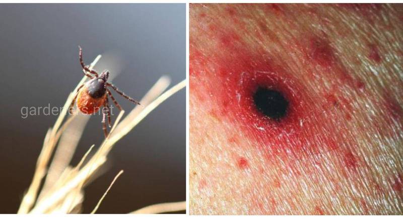Клещевой сыпной тиф Северной Азии - острое инфекционное заболевание, переносчиком которого являются иксодовые клещи