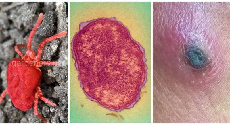 Заболевание, которое переносят краснотелковые клещи - лихорадка цуцугамуши