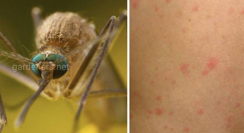 Карельская лихорадка - вирусная болезнь, которую передают человеку комары от птиц