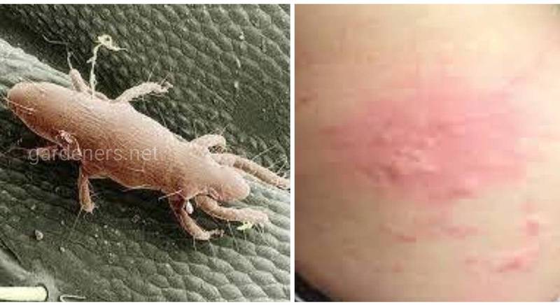 Пузатий кліщ - паразит комах, збудник піємотозу бджіл та піємотозної корости у людини
