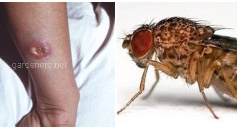 Трипаносомоз Африканський (сонна хвороба) - гостра інфекційна хвороба, переносником якої є муха цеце