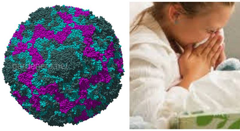 Энтеровирусная инфекция - определение и основные формы